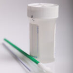 Gezeigt wird ein Aufbewahrungsgefäß für einen zytologischen Spezialabstrich, den wir zum Beispiel im Rahmen der Vorsorgeuntersuchung aus dem Muttermund entnehmen.